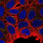 MTMR2 Polyclonal Antibody