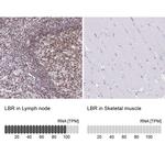 Lamin B Receptor Polyclonal Antibody