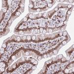 Lamin B Receptor Antibody in Immunohistochemistry (IHC)