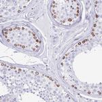 Lamin B Receptor Antibody in Immunohistochemistry (IHC)