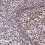 Lamin B Receptor Antibody in Immunohistochemistry (IHC)