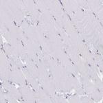 Lamin B Receptor Antibody in Immunohistochemistry (IHC)