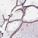 MAGT1 Antibody in Immunohistochemistry (IHC)