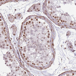ZGLP1 Antibody in Immunohistochemistry (Paraffin) (IHC (P))