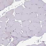 TMEM121 Antibody in Immunohistochemistry (Paraffin) (IHC (P))