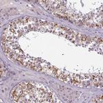PBX4 Antibody in Immunohistochemistry (Paraffin) (IHC (P))