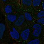 PBX4 Polyclonal Antibody