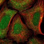 ZNF14 Polyclonal Antibody