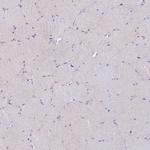 DDHD1 Antibody in Immunohistochemistry (Paraffin) (IHC (P))