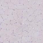 DDHD1 Antibody in Immunohistochemistry (IHC)