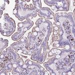 Cathepsin Z Antibody in Immunohistochemistry (Paraffin) (IHC (P))