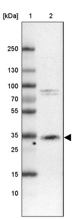 Cathepsin Z Antibody in Western Blot (WB)