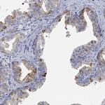 ZNF852 Polyclonal Antibody