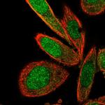 TNIP2 Polyclonal Antibody