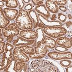 TNIP2 Antibody in Immunohistochemistry (Paraffin) (IHC (P))