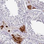 PRAMEF7 Antibody in Immunohistochemistry (Paraffin) (IHC (P))