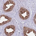 AP1S2 Antibody in Immunohistochemistry (IHC)