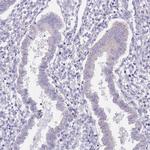 AP1S2 Antibody in Immunohistochemistry (IHC)