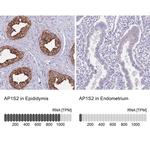 AP1S2 Antibody
