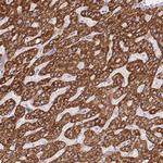 ACSM4 Polyclonal Antibody