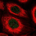 TOX2 Polyclonal Antibody