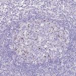 TOX2 Antibody in Immunohistochemistry (IHC)