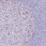 TOX2 Antibody in Immunohistochemistry (IHC)