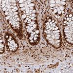 DATF1 Antibody in Immunohistochemistry (Paraffin) (IHC (P))