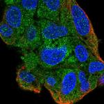 ZNF167 Polyclonal Antibody