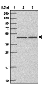ZNF167 Antibody in Western Blot (WB)