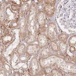 ZNF167 Antibody in Immunohistochemistry (IHC)