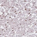 OR10AD1 Antibody in Immunohistochemistry (Paraffin) (IHC (P))
