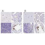 C2orf57 Antibody in Immunohistochemistry (IHC)