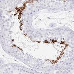 C2orf57 Antibody in Immunohistochemistry (IHC)