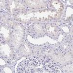 C2orf57 Antibody in Immunohistochemistry (IHC)