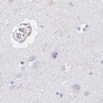 C2orf57 Antibody in Immunohistochemistry (IHC)