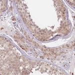 SPATA45 Polyclonal Antibody