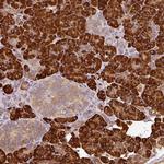 ANKRD18A Polyclonal Antibody