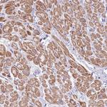OR4Q3 Antibody in Immunohistochemistry (Paraffin) (IHC (P))