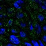 BTBD7 Polyclonal Antibody