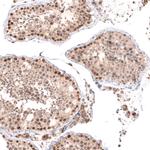 BTBD7 Antibody in Immunohistochemistry (IHC)