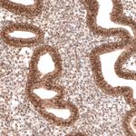 BTBD7 Antibody in Immunohistochemistry (IHC)