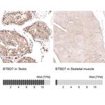 BTBD7 Antibody