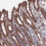 TWA1 Polyclonal Antibody