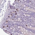 ZNF697 Antibody in Immunohistochemistry (Paraffin) (IHC (P))