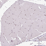 SRRM1 Antibody in Immunohistochemistry (Paraffin) (IHC (P))