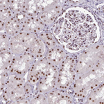 SRRM1 Antibody in Immunohistochemistry (Paraffin) (IHC (P))