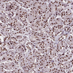 SRRM1 Antibody in Immunohistochemistry (Paraffin) (IHC (P))
