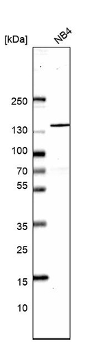 SRRM1 Antibody in Western Blot (WB)