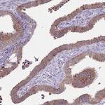 TCP-1 zeta Antibody in Immunohistochemistry (Paraffin) (IHC (P))
